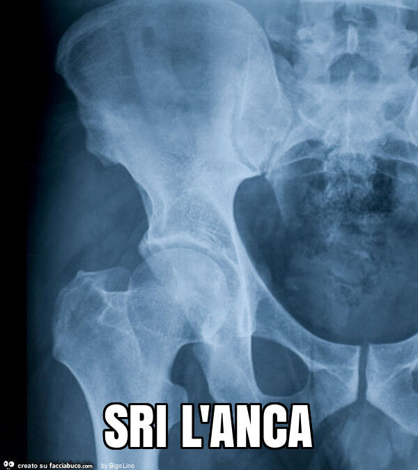 Sri l'anca