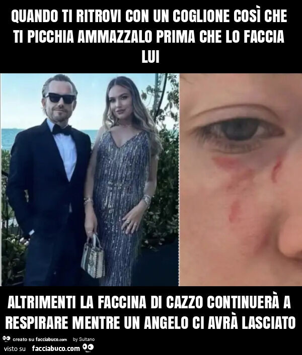Quando ti ritrovi con un coglione così che ti picchia ammazzalo prima che lo faccia lui altrimenti la faccina di cazzo continuerà a respirare mentre un angelo ci avrà lasciato