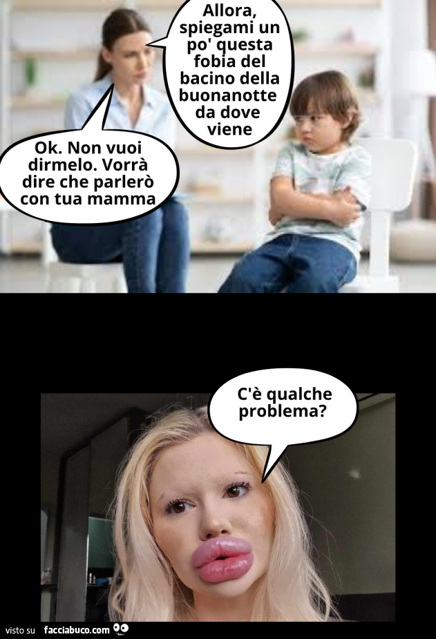 Labbra rifatte