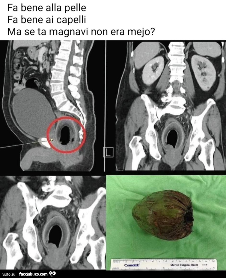 Fa bene alla pelle ai capelli ma se tela magnavi non era mejo noce di cocco