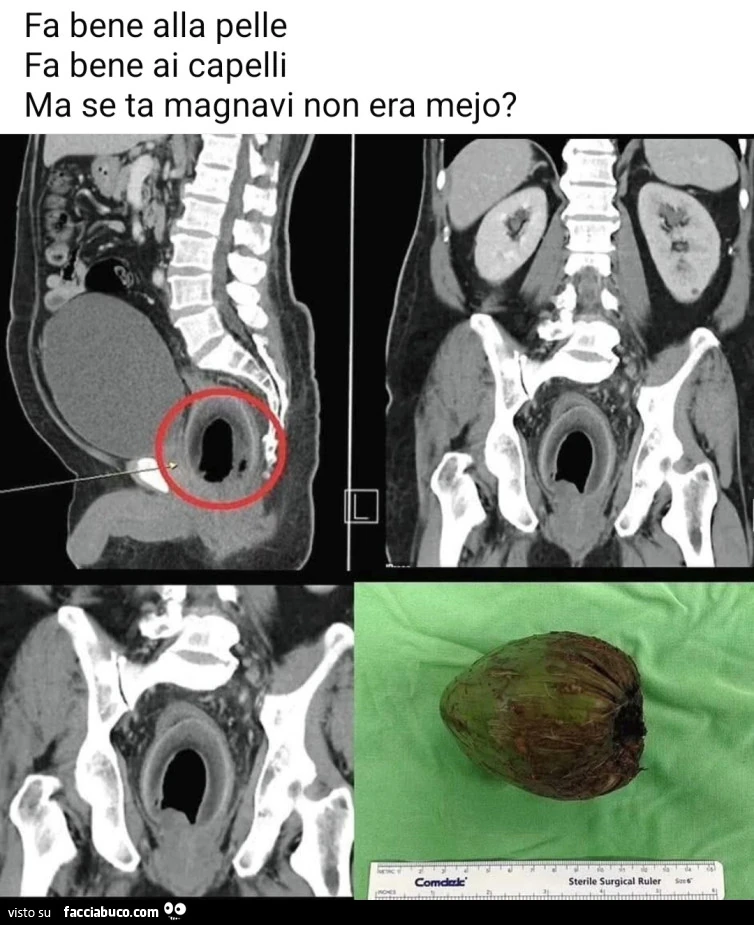 Fa bene alla pelle ai capelli ma se tela magnavi non era mejo noce di cocco