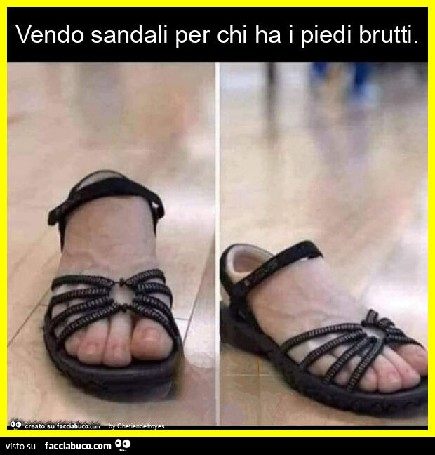 Vendo sandali per chi ha i piedi brutti