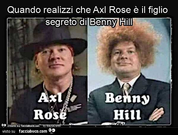 Quando realizzi che axl rose è il figlio segreto di benny hill