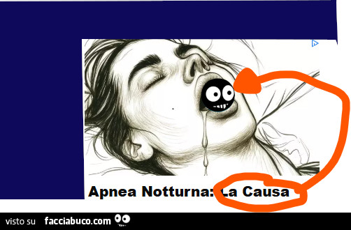Apnea notturna su Facciabuco