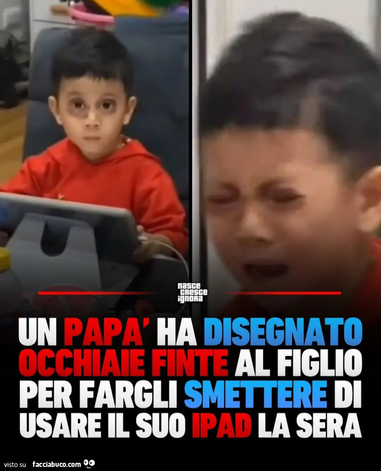Un papร ha disegnato occhiaie finte al figlio per fargli smettere di usare il suo ipad la sera