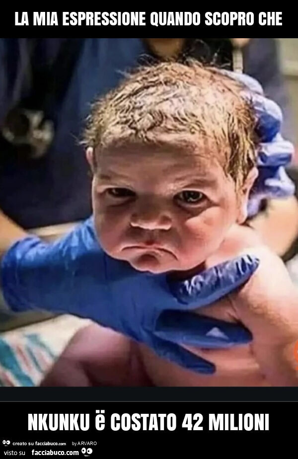La mia espressione quando scopro che nkunku ë costato 42 milioni