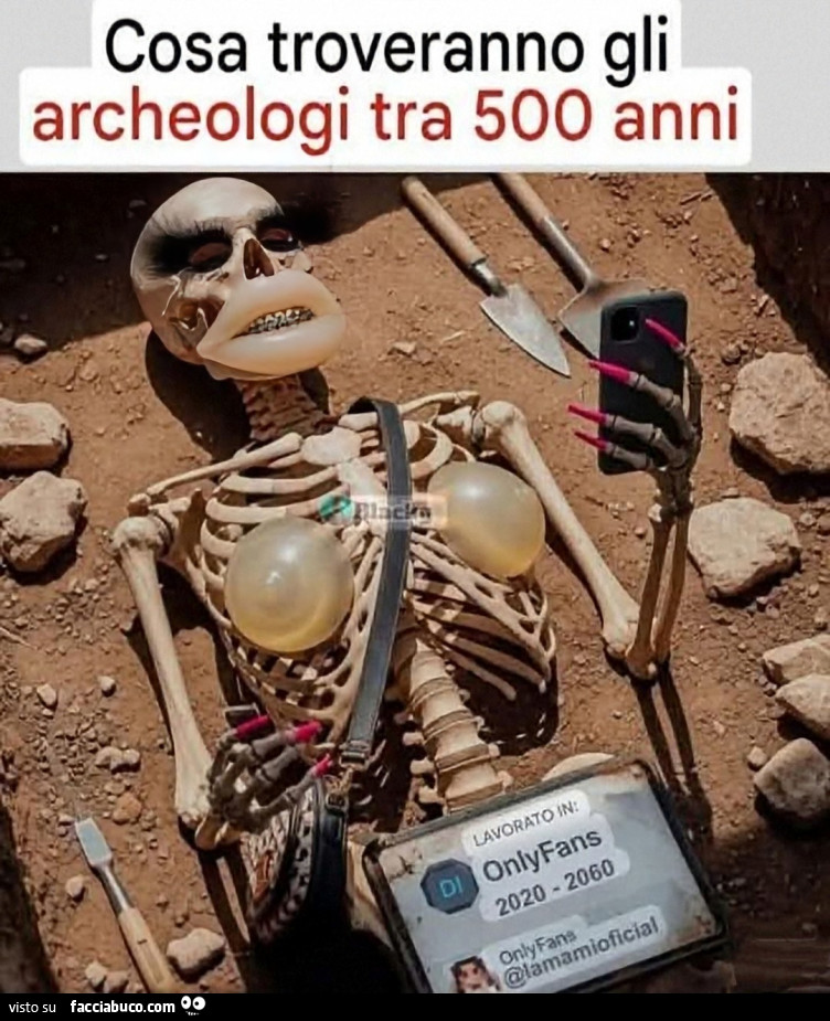 Protesi