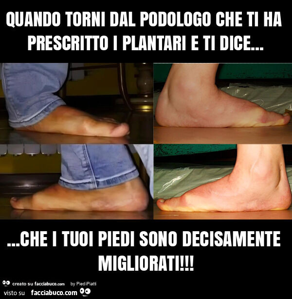 Quando torni dal podologo che ti ha prescritto i plantari e ti dice… che i tuoi piedi sono decisamente migliorati